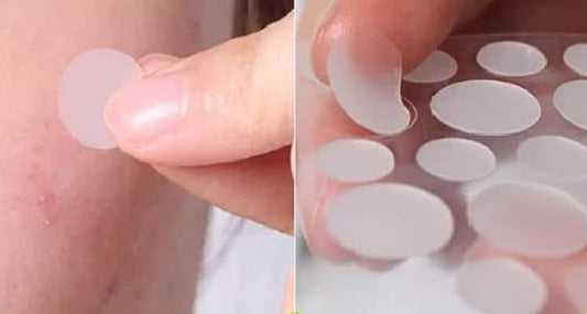 Hydrocolloid Acne Patch with Salicylic Acid to safely heal pimples fast. 72 patches in 2 sizes.