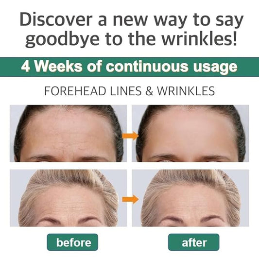 Forehead Wrinkle Patches Reusable made of Silicone | Forehead Wrinkles Treatment | Silicone Patches For Wrinkles | Non Invasive Reusable Wrinkle Smoothers…, Clear