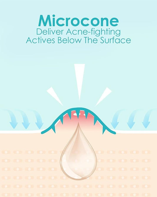 Microdart Acne Patch (27 Patches) - Hyaluronate Acid & Salicylic Acid Hydrocolloid Pimple Patch for Deep, Early and Hidden Blemishes (27 Count (Pack of 1))