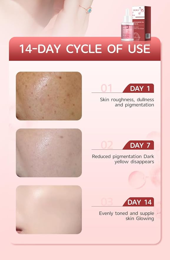 10% Niacinamide+ 4% Tranexamic Acid Serum,Hyaluronic Acid, Vitamin B12,Fragrance-Free (30ml /1.01 fl.oz.)