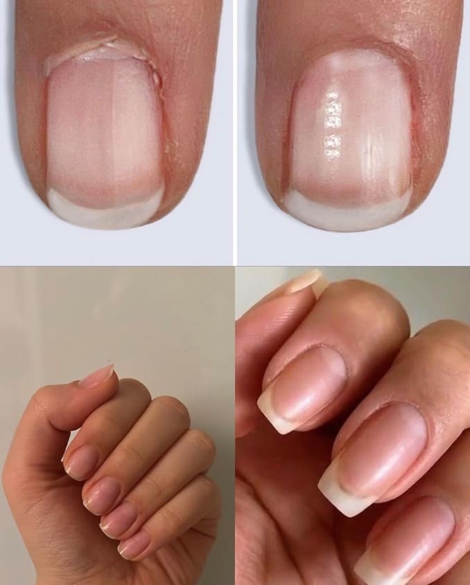 Nail Oil Cuticle Pen I Nail Growth Pen I Pure Essentials Cosmetics I Nail Strengthener I Nail Growth Serum I Fast Results I Healthy Nails