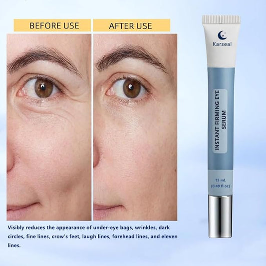 Instant Firming Eye Serum – Targets Under-Eye Bags, Wrinkles, Dark Circles & Fine Lines – Anti-Aging Formula (15ml / 0.49 oz)