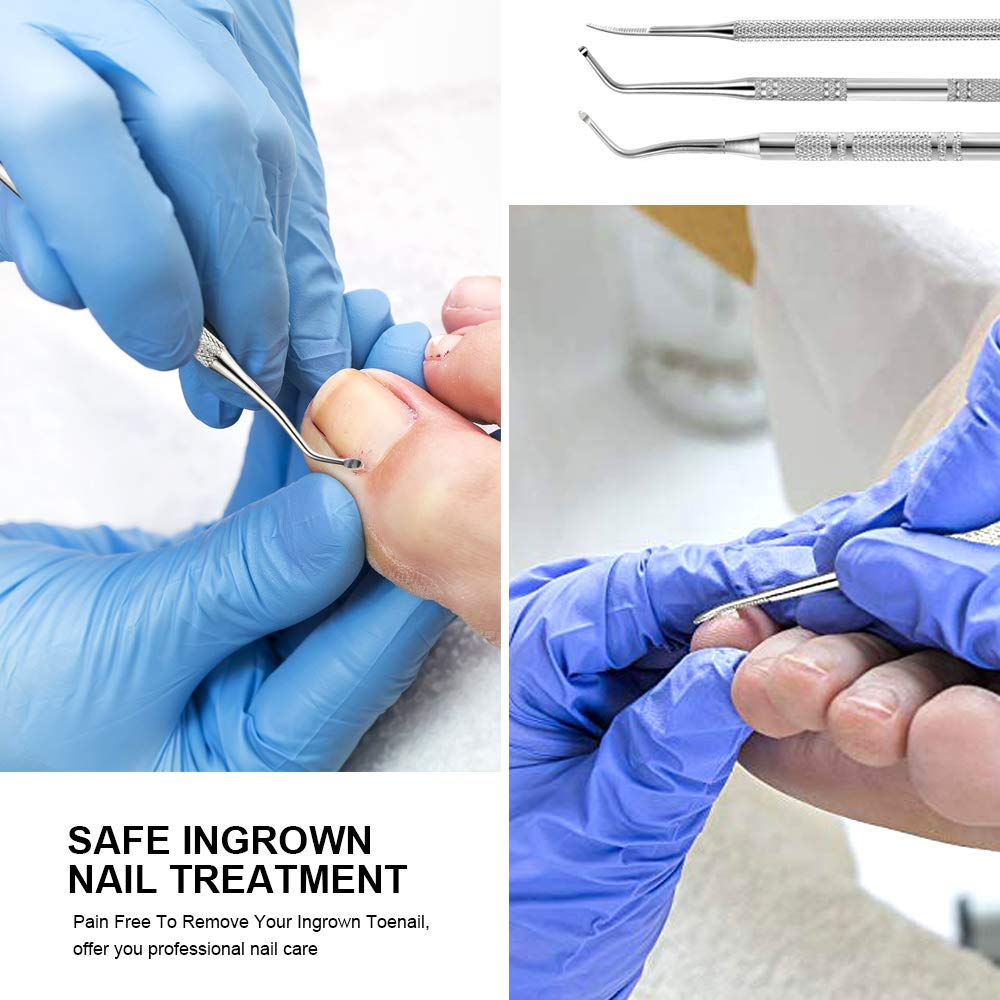 Teenitor Pedicure Tools for Feet, Toenail File and Lifters, Upgraded Professional Surgical Safe Ingrown Toenail Treatment Ingrown Toenail Removal Kit Ingrown Toenail Tool