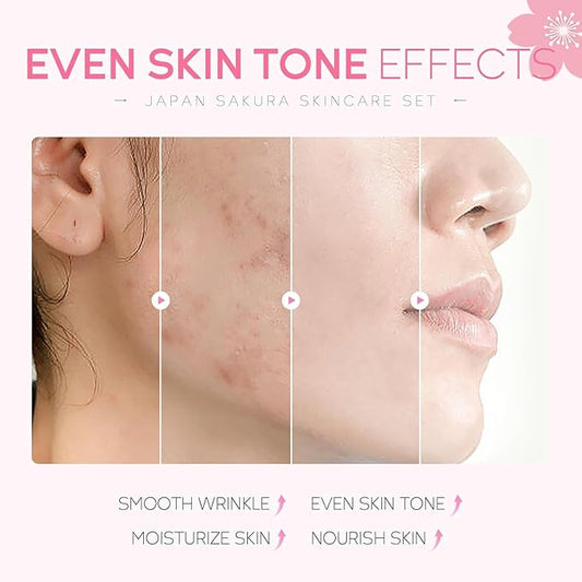 SAKURA Skin Care Set, Skin Care Sets & Kits Women Girls Gift Set with Cleanser, Face Serum, Face Cream, Toner, Eye Cream, Travel Size Skincare Set for Women Teen Girls Birthday Christmas Gift (SAKURA)