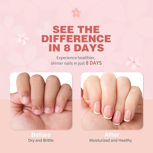 Cherry Blossom Nail & Cuticle Oil - Ultimate Hydration, Repair with Real Cherry Blossom Extract - Paraben-Free, Vegan & Cruelty-Free - 0.5 fl. oz