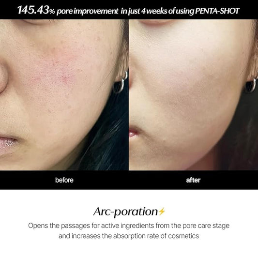 Potension Penta-Shot - Korean Skin Care Device, 5-in-1 Total Care Device for Enhanced Absorption, Intensive Pore Care, Needle Free, Professional Skincare Comfortably at Home