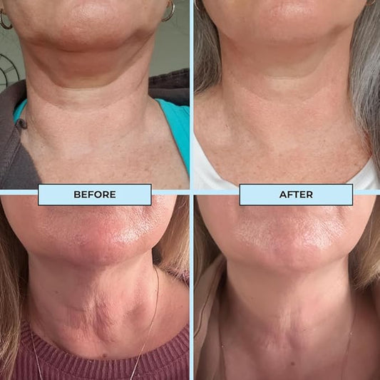 BOOST LAB Edelweiss Neck Firming Serum - Reduce Neck Wrinkles & Neck Ageing - Lifts & Smooths Crepe-Like, Sagging Skin - Paraben Free, Sulphate Free, Fragrance Free - 30 ml (1 fl oz)