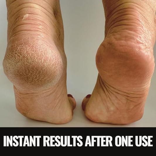 SandBar Heel Revival Regimen Mother's Day Gift - Home Pedicure Kit, Foot Spa Kit Pedicure Set, Foot Care Products for Soft, Smooth, Callus-Free Feet - Hawt Dawn