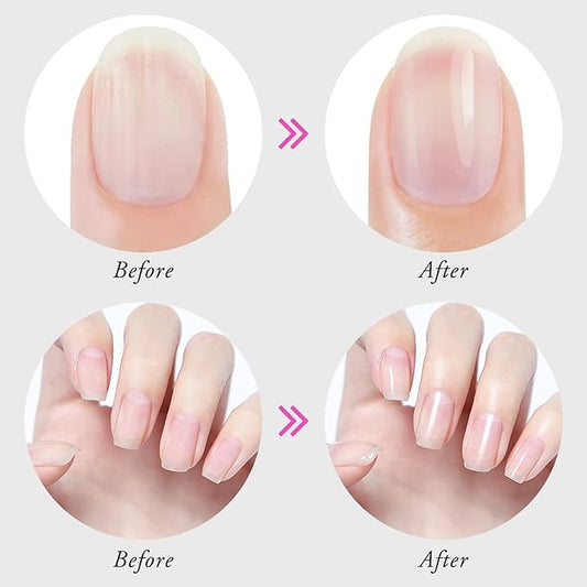 Cuticle Oils, Hydrating Oil for Repaired Cuticles, Nail Growth and Strengthener, Remedy for Thin Nails