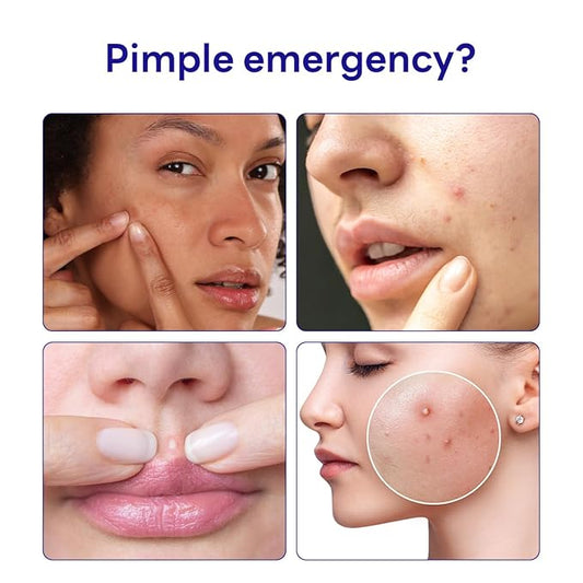 Mediheal Derma Clear Teatree Treatment Spot Patch (44 Counts) - Acne Relief, Oil and Moisture Balance with Teatree & Salicylic Acid