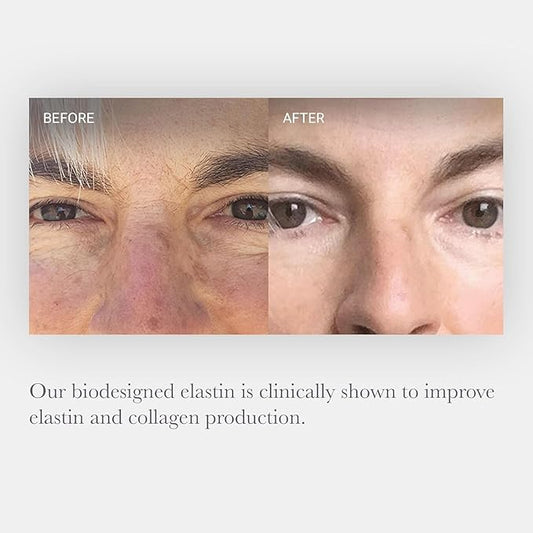 NULASTIN Hydrating Face Moisturizer for Women & Men - SKIN Rejuvenating Facial Moisturizer - With Smoothing, Firming Elastaplex to Nourish Aging Skin - Radiant Night & Day Cream (1.7 Oz)