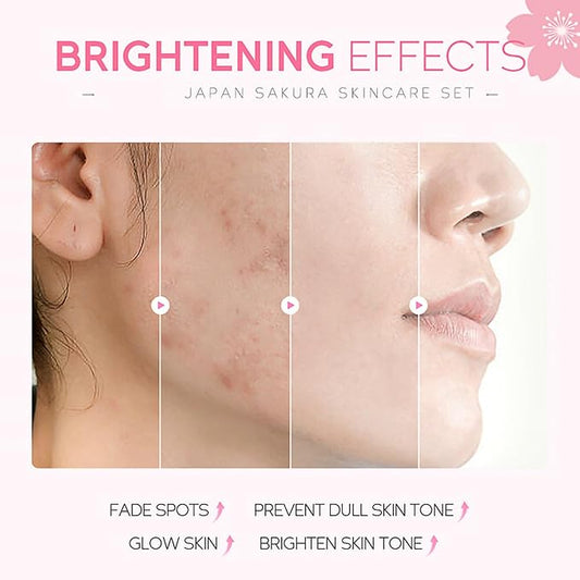 Skincare Gifts For Teenage Girls,Cherry Blossom Skincare Sets,Facial kit,Pamper Sets For Women Gifts,Skin Care Sets & Kits (One Size, Cherry Blossom-SetA-Base Moisturizing)