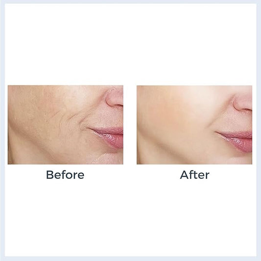 Black Pearl Collagen Mask – Hydrating & Firming