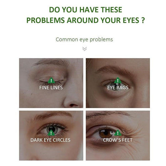 Aloe Vera Eye Serum for Dark Circles,Deeply Moisturizing,Anti Aging, Smooth Fine Lines and Crows Feet,Tightening and Lifts Eye Skin,Enhance Skin Elasticity,Fragrance Free(1 OZ)