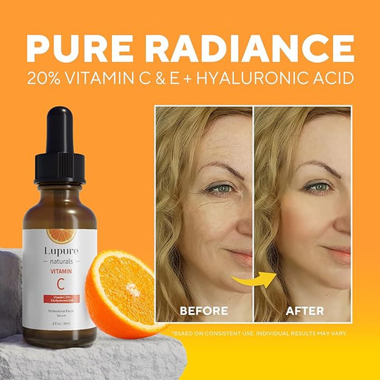 Professional Vitamin C Face Serum 20%, Anti Aging Facial Super Vit C Serum with Ascorbic Acid Hyaluronic Acid & Vitamin E for Dark Spots, Skin Care, Christmas Gift & Stocking | 1 Fl. Oz