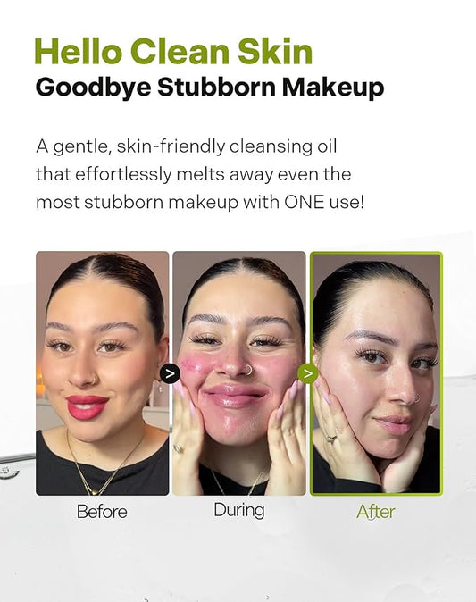 P.CALM Underpore Holy Basil Cleansing Oil – Holy Basil & Tea Tree for Deep Pore Cleansing, Blackhead Removal, and Makeup Removal, Korean Skincare (190ml / 6.42 fl.oz)