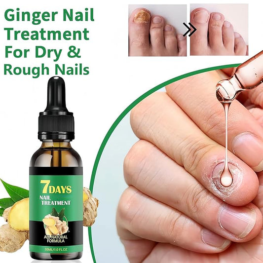 2Pcs Ginger Nail Growth and Strengthener-Nail Growth Serum-30ML Each Natural Nail Strengthener for Damaged Nails-Ginger Nail Treatment