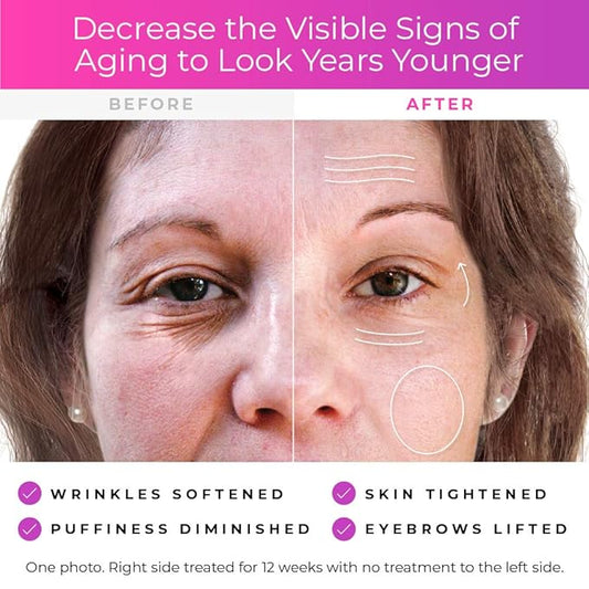 Derma Wand Anti-Aging System - Portable Handheld Skincare Therapy Machine- Argon/Neon