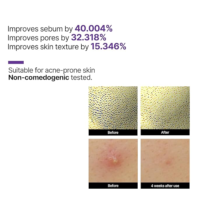 SOME BY MI Retinol Intense Reactivating Serum 50ml + Retinol Intense Advanced Triple Action Eye Cream