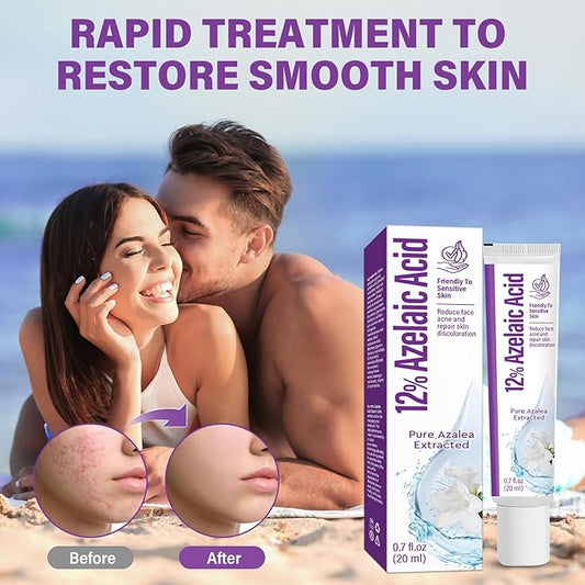 Azelaic Acid Serum, Azelaic Acid 12% Facial Cream, Hyaluronic Acid & Niacinamide for Redness Relief Face, Balance Excess Sebum, 20g