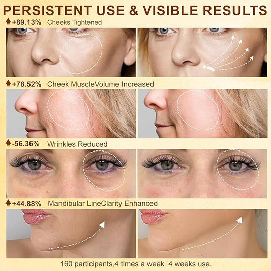 Microcurrent Facial Device,Radio Frequency Skin Tightening Face Machine Treatment of Facial Wrinkles and mild to Moderate inflammatory