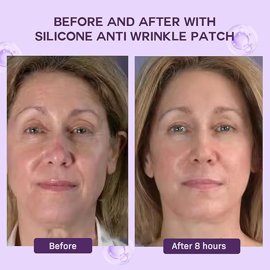 ACADA Anti Wrinkle Patches Reusable Silicone Face Patches for Wrinkles, Facial Wrinkle Patches for Forehead, Eyes, Mouth and Neck(Gel Patches 6pcs)