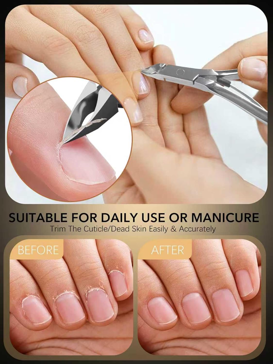 Salon-Quality Cuticle Cutter Nippers Profession Cuticle Trimmer Super Sharp Cuticle Cutter Manicure Nail Cuticle Remover Clippers Tools, 5mm Jaw