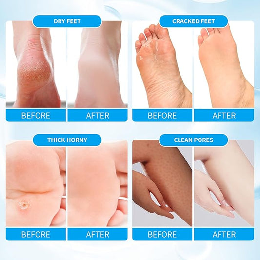 Pedicure Kit Foot Soak Set: Bubble Salt, Sugar Scrub, Massage Mask, Massage Lotion in a Box, 4 Step Foot Spa Kit for Dry Feet, Softens Calluses(1 Set Pacific Waves)