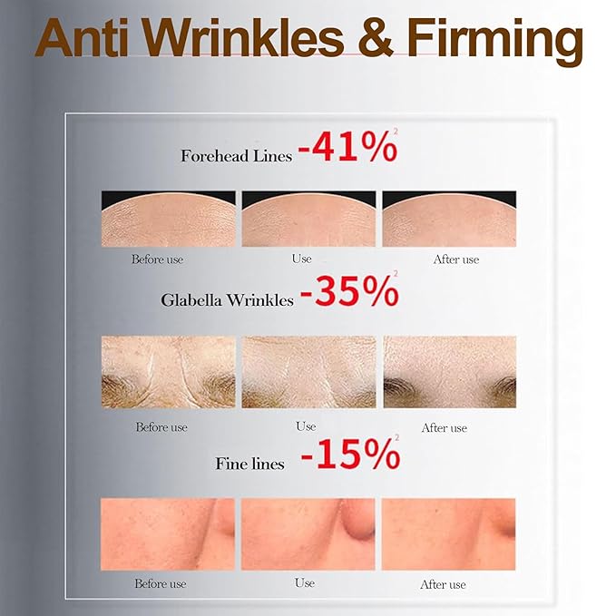 2 Pack Bo-tox Bee Venom Cream for Lifting & Firming Saggy Face/Neck/Eyes, Wrinkle & Fine Lines & Eye Bag Removal, Restoring Elasticity & Deeply Moisturizing, Natural Bee Venom Serum for All Skin Types