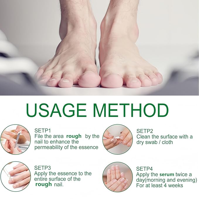 Ginger Nail Treatment-Nail Strengthener for Damaged Nails-Mild Nail Growth Serum for Gingernail & Toenail-Easy to Use, 1Pc 30ML