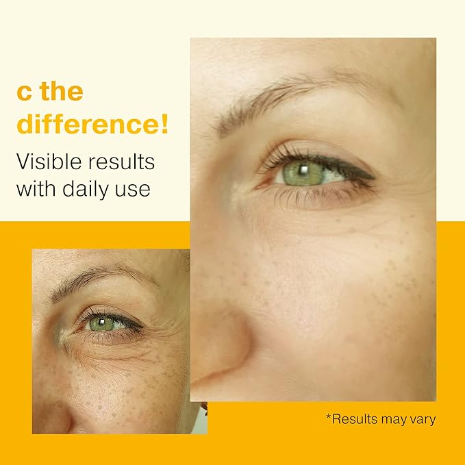 Retinol Serum for Face 2OZ + Vitamin C Face Serum 2OZ