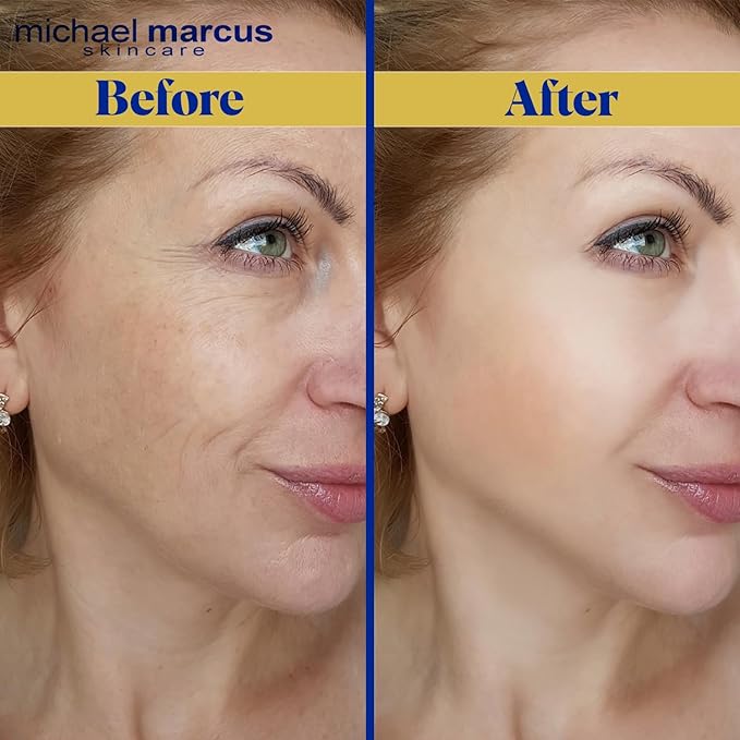 Michael Marcus Anti Fatigue Eye Masque (1 Fl oz) - Eye Cream for Puffy Eyes, Dark Circles, and Wrinkles - Moisturizing for Men & Women โ Natural, Hydrating & Cruelty Free Eye Skincare