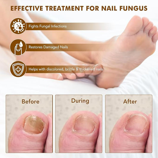 7 Day Ginger Nail Treatment 60ml, Nail Treatment, Nail Growth Serum, Ginger Nail Serum, Nail Nutrient Oil Strengthener Oil.
