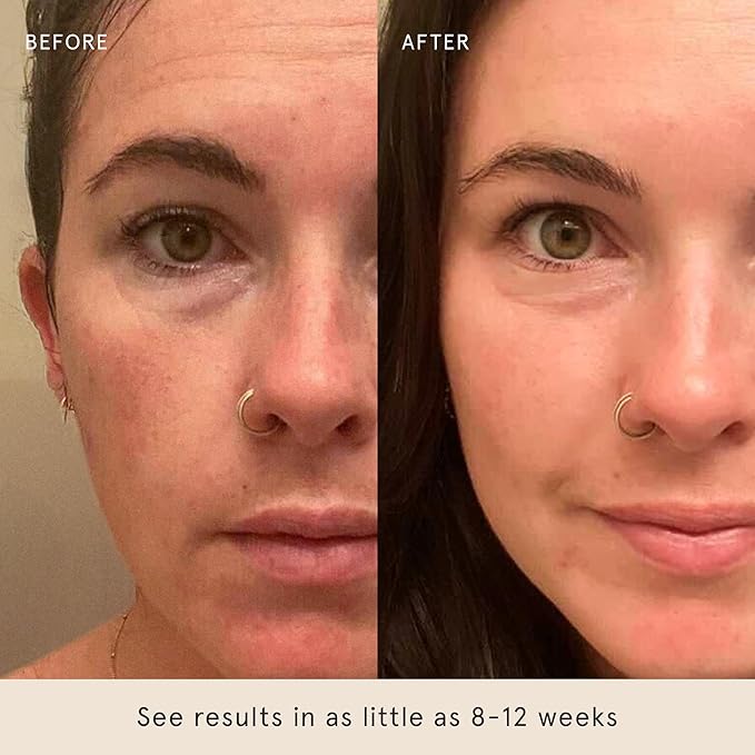 Barefaced Overachiever 30 mL - 10-in-1 Skin Booster with Bakuchiol, Resveratrol & Green Tea - Retinol Alternative, Pregnancy Safe, Helps with Hydrating Skin & Minimizes Pores, Reduces Redness, Wrinkles & Fine Lines