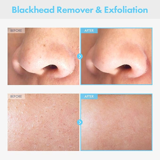 Pure Deep Cleansing Oil with AHA+PHA, Argan, Jojoba Oil, Centella Asiatica, Blackhead Remover, Oil Based Cleanser for Face, Sebum Control, Pore Cleaner, kbeauty Skincare, 145ml, 4.9 fl. oz.