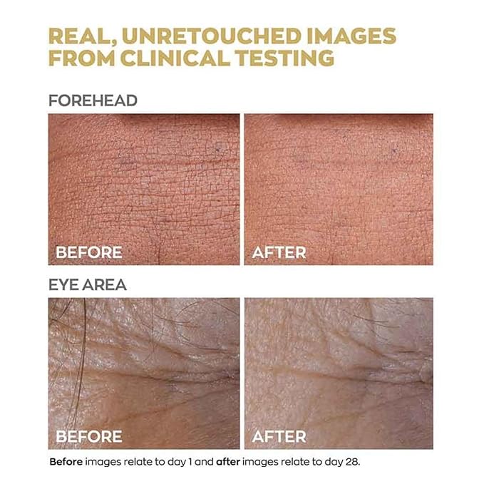 Anew Skin Renewal Power Serum - Dual-Collagen Boost, Protinol Technology, 30ml Powerful Results in 7 Days. Smoothes Skin, Reduces Pores and Minimises Lines for Firmer, Stronger,