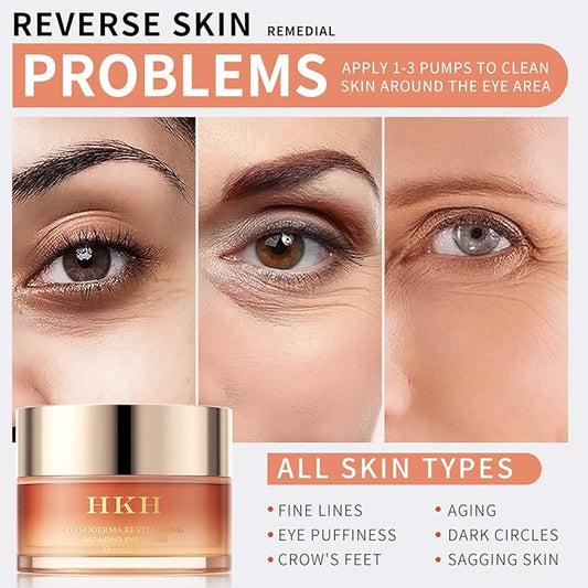 Dark Circles Under Eye Treatment for Women - Eye Cream for Dark Circles Wrinkles Puffiness & Fades Fine Lines, Fade Dark Circles Anti-Aging Collagen Eye Cream – Retinol Peptide