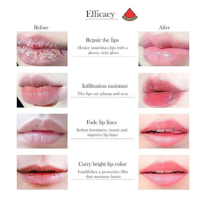 6 PCS Bee Lip Balm Honey Pot, Honey & Strawberry & Watermelon & Apple Lime & Cherry & Mint Lip Sleeping Mask Overnight, Bee Lip Balm Honey Pot Hydrating Prevention Dry and Cracked Lip Scrubs (Set B)