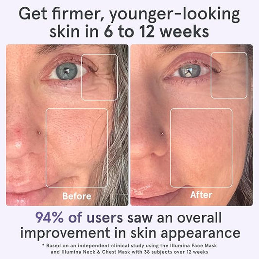 iRestore LED Face Mask Light Therapy | Blue, Infrared & Red Light Therapy for Face | Illumina Skincare Device Facemask - Youthful Radiant Skin with Reduced Wrinkles, Fine Lines | Contour | 360 LEDs