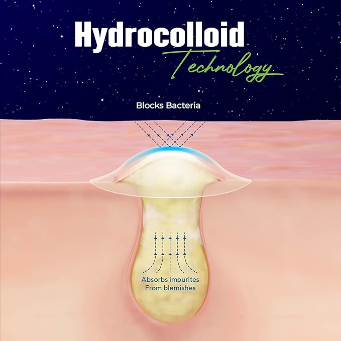 Star Pimple Patches for Face – Hydrocolloid Acne Patches for Quick Zit Relief and Blemishes, Invisible Spot Stickers That Stay All Night, Gentle for All Skin Types, Oil-Free (240 Count)