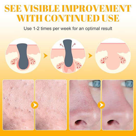 Blackhead Remover Strips(80pcs), Nose Pore Strips for Blackheads Remover, Skincare & Deep Cleansing Nose Strips Blackhead Remover