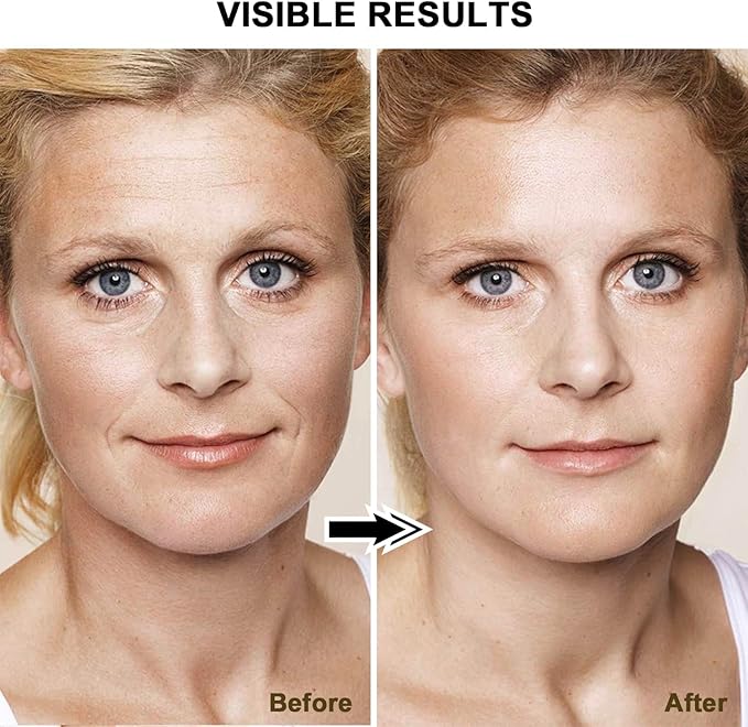 Radiant Renewal Skincare Wand, HD-15 Red-Light-Therapy- Face Wand for Face Eye Skincare Equipment with 7 Color, Facial Massager