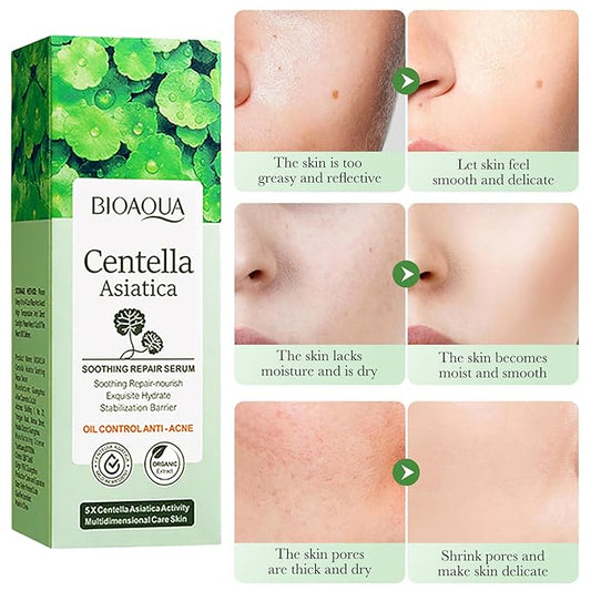 BIOAQUA Centella Asiatica Soothing Repair Facial Serum Nourish Oil Control Anti-Acne Face Skin Care 30ml / 1fl.oz