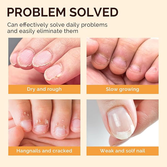 MelodySusie 15Pcs Cuticle Oil Pen Set,Nail Moisturizing Cuticle Oil Enriched with Vitamin E,Softens and Repairs cuticles,Nail Strengthener,Protects Damaged Skin,Thin Nails