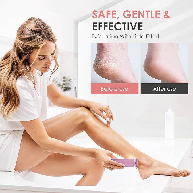 Electric Foot Callus Remover, Adjustable Speed with 60 Discs Callus Remover for Feet, Dead Skin Cracked Heels, Professional Electric Foot File for All (Pink)