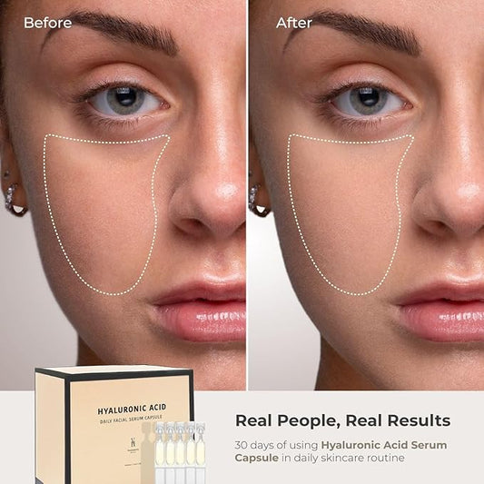 VivienneHu Hyaluronic Acid Serum Capsules, Hydrating Serum for Face with Retinol, Intense Hydration & Skin Plumping, Daily Facial Hydration Serum, Face Plumping Serum - 30 Capsules