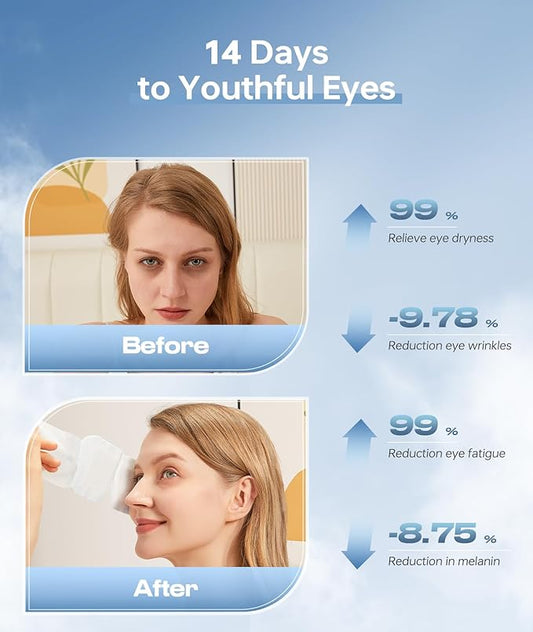 Hyaluronic Acid Self Heating Warm Compress for Eyes, Heated Eye Mask for Fast Relief of Dry Eyes, 7 Pack Steam Eye Mask, Moisturizing & Highly Effective Steam Eye Mask