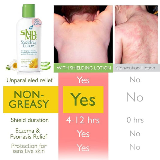 Skin MD Shielding Lotion 4oz. - hydrating, non-greasy, relief & serious protection for sensitive skin