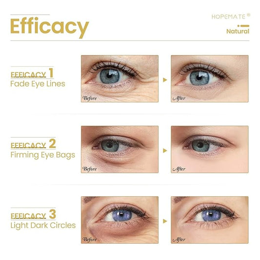 Eye Cream for Dark Circles, Puffiness, and Wrinkles, Improves and Firms eye Skin for Youthful, Refreshed Eyes-Pure Natural Material Extraction