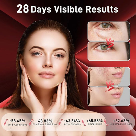 Red Light Therapy Mask for Face - 3 Light Modes, Ultra-Soft Comfort, Precise wavelength, Professional LED Face Mask Light Therapy for Skin Rejuvenation, Anti-Aging & Acne Treatment, Home Use